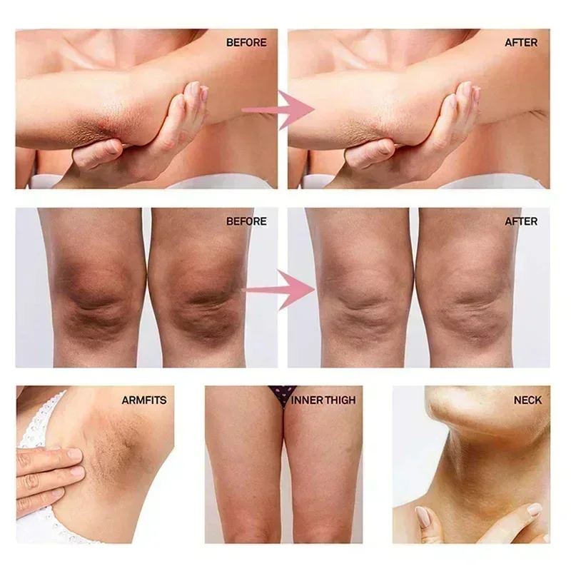 Collagen underarm whitening cr - Anti-Aging Face Cream review and price
