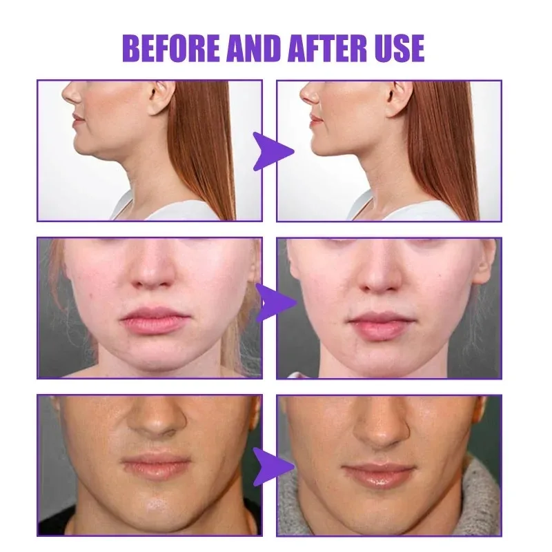 Face-lift Slimming Cream Slimm - Anti-Aging Face Cream review and price