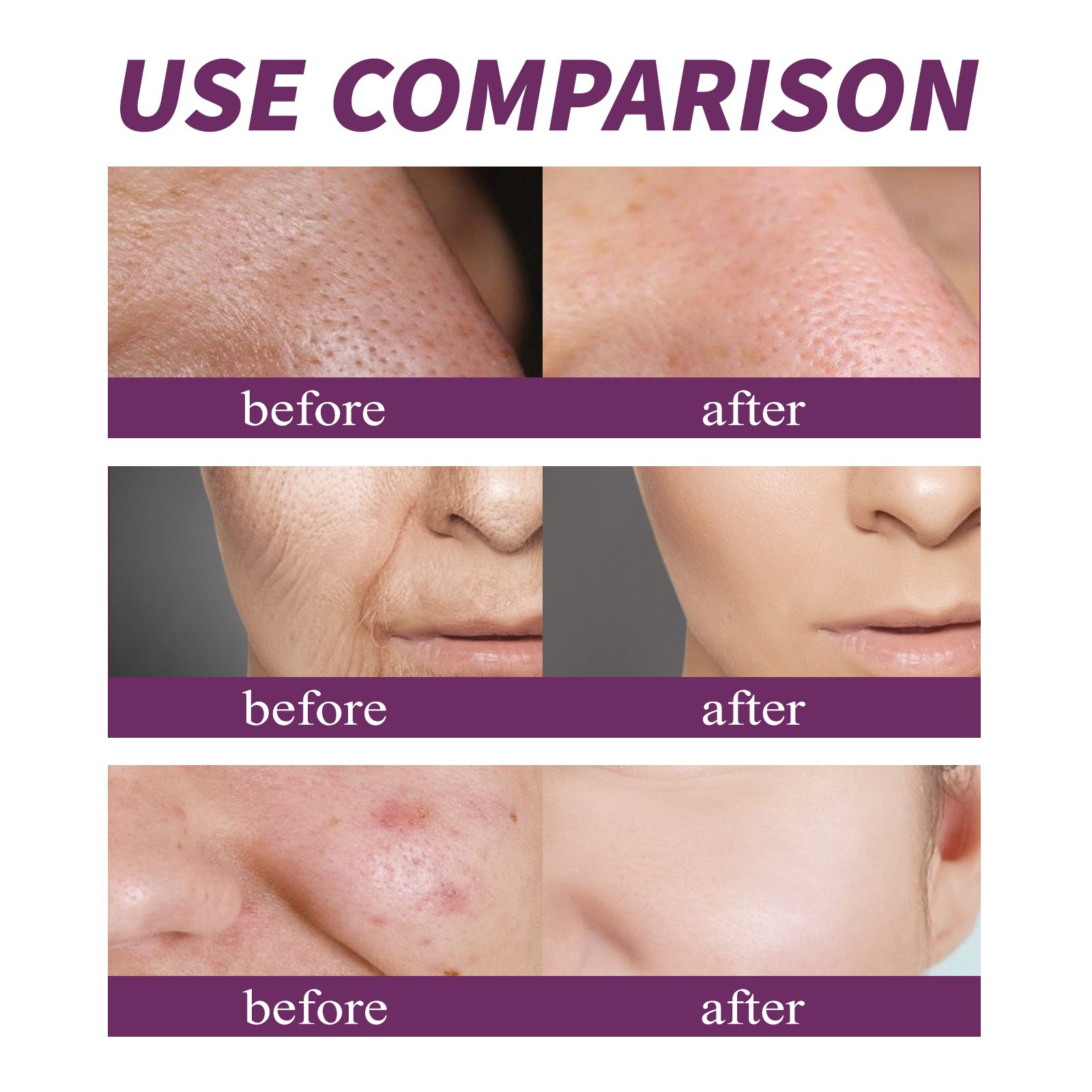 20% Niacinamide B3 Concentrate - Anti-Aging Face Cream review and price