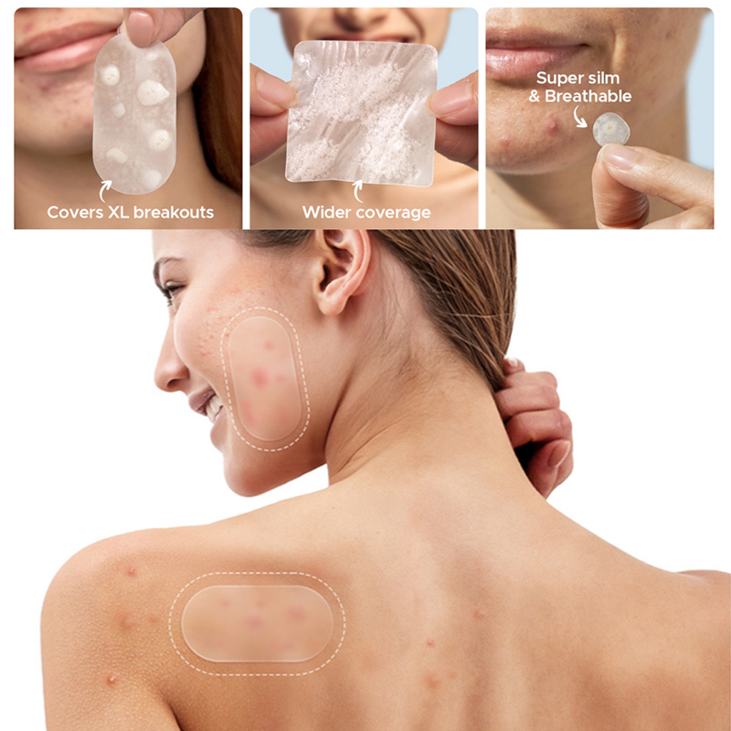 New 116Pcs Invisible Anti-Acne - Beauty Makeup & D Anime Studio Vega Baja review and price